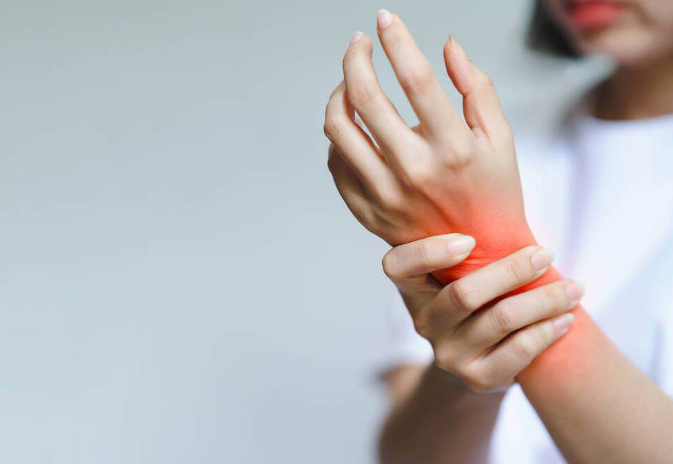 Modafinil Rheumatoid Arthritis