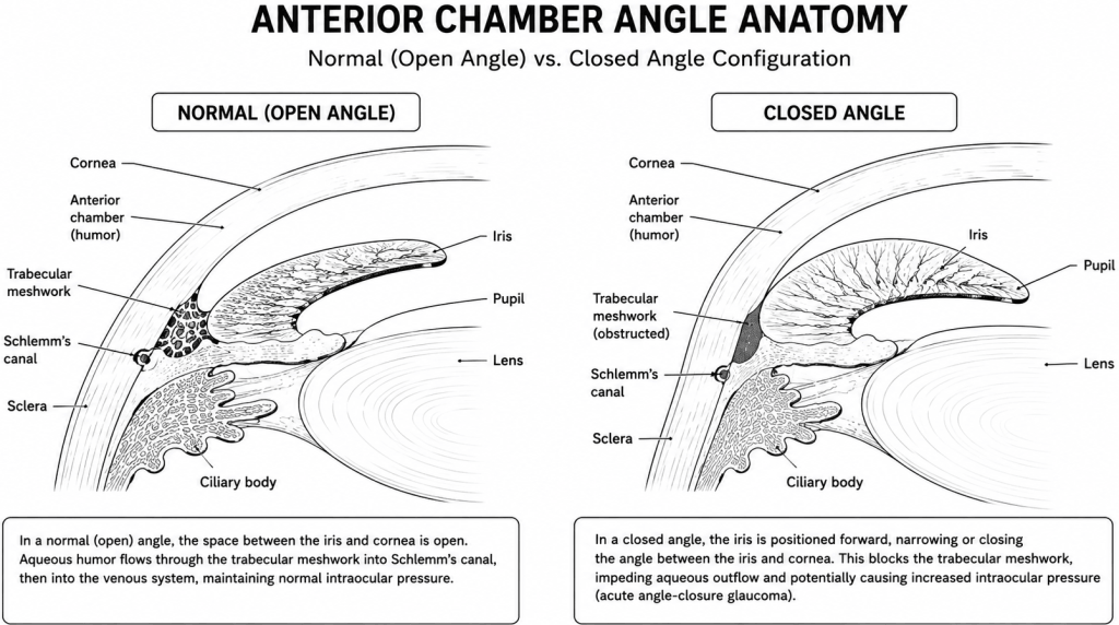 Anatomical comparison of normal anterior chamber angle versus narrow angle configuration predisposing to angle-closure glaucoma